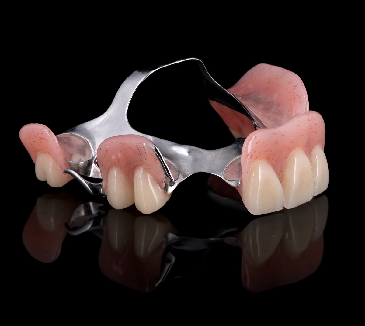 CPD PARTIAL DENTURE 2