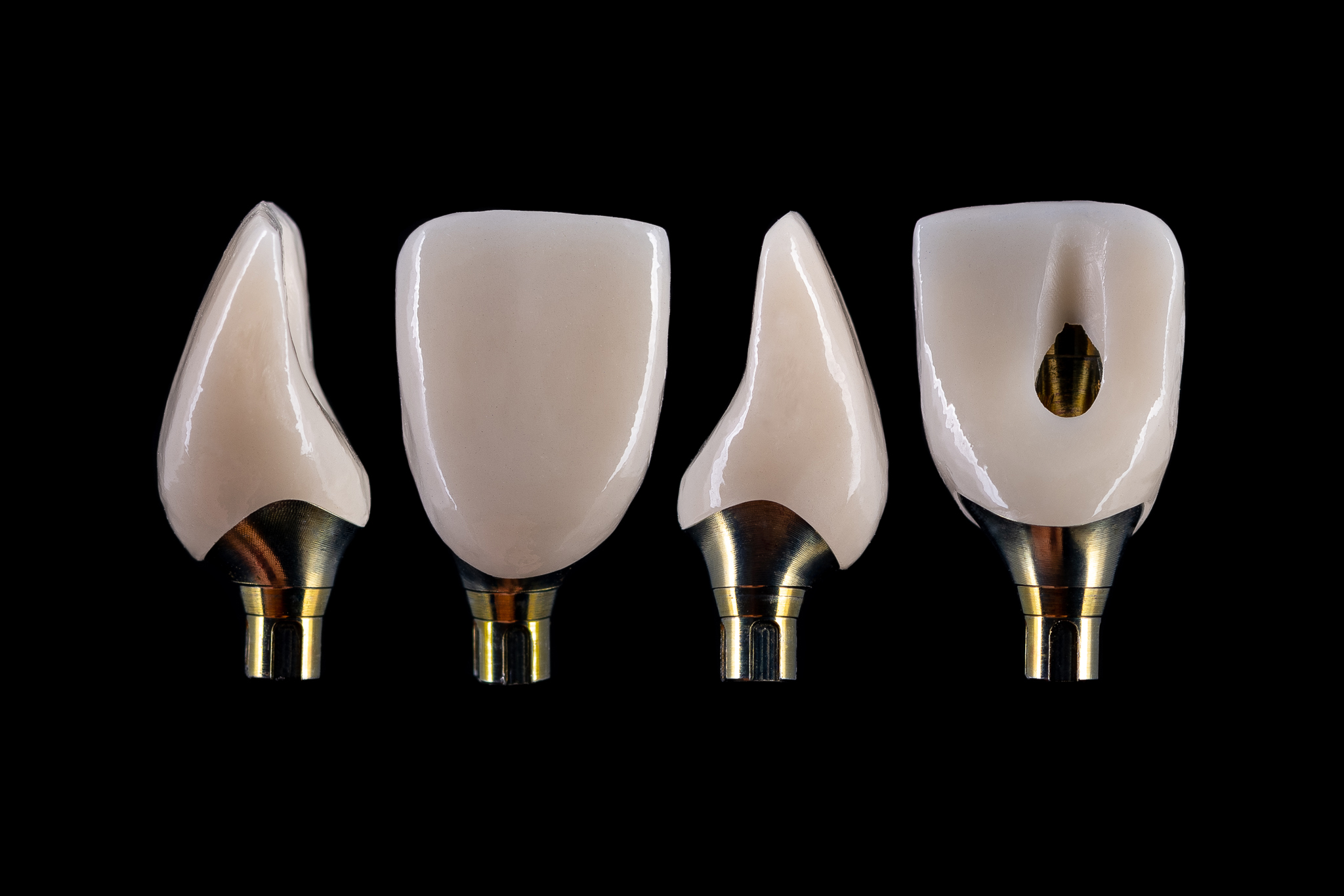 Implant Crown With Ti-base 1